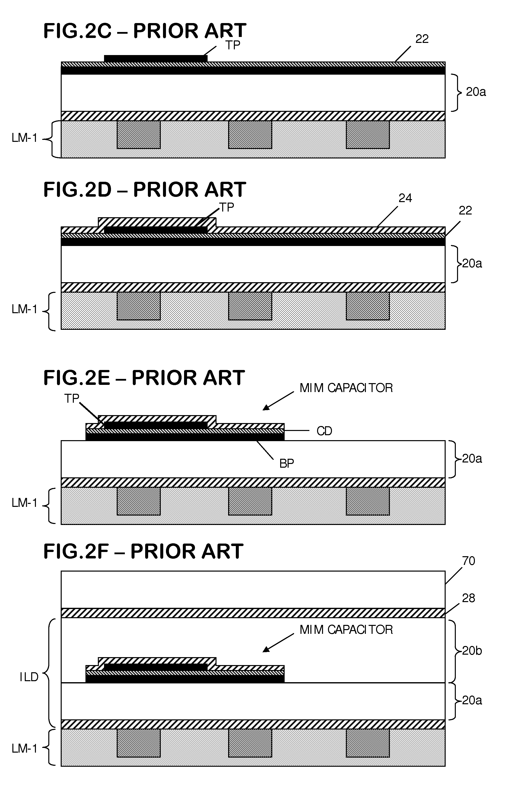 MIM capacitor integration