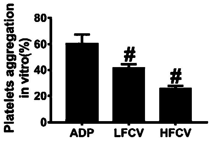 Application of nucleoside type antiviral medicine to preparation of medicine for treating infarction diseases