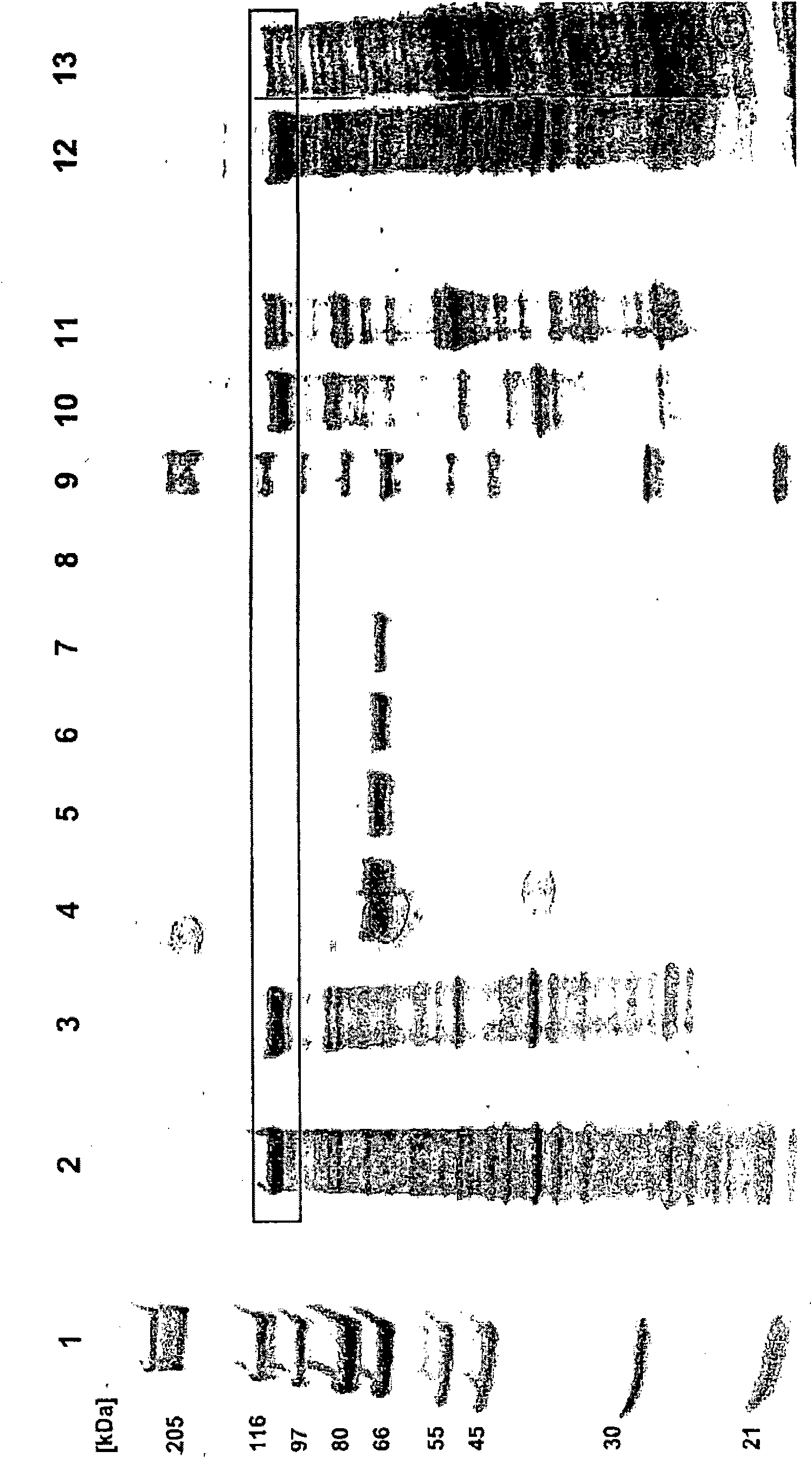 Recombinant malaria vaccine