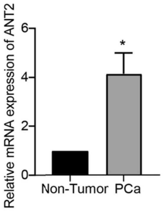 A pharmaceutical composition for preventing and treating cancer and its application