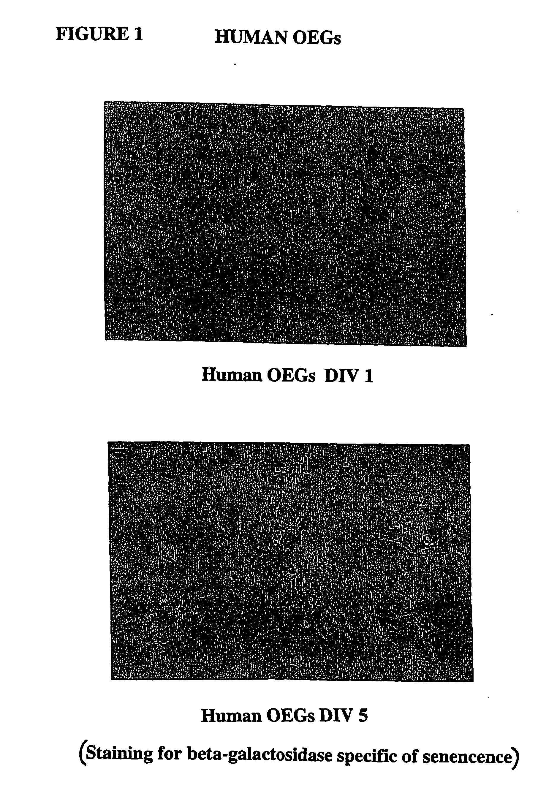 Reversibly immortalised olfactory ensheathing glia and their use to promote neuronal regeneration