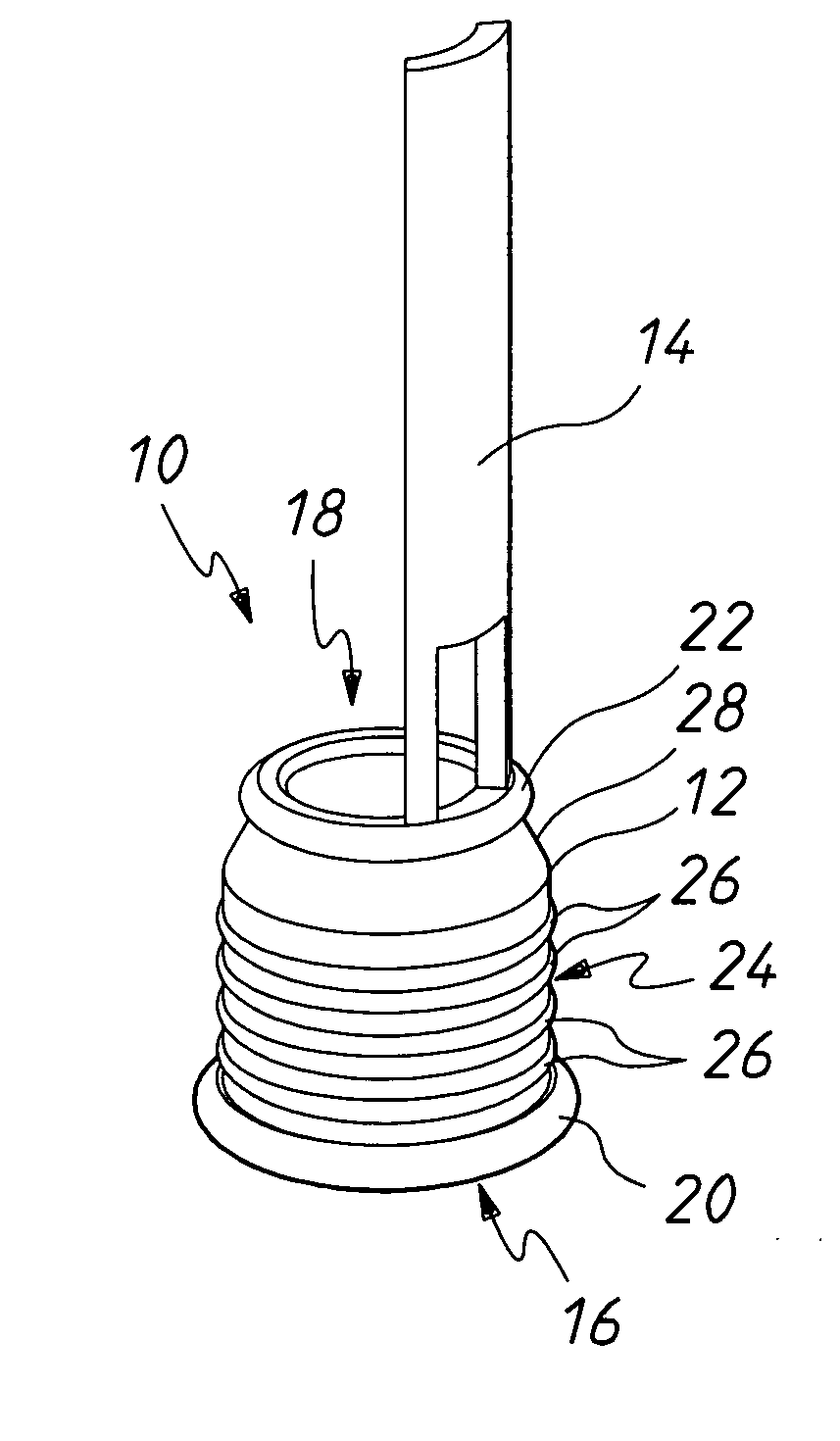 Circumcision Device