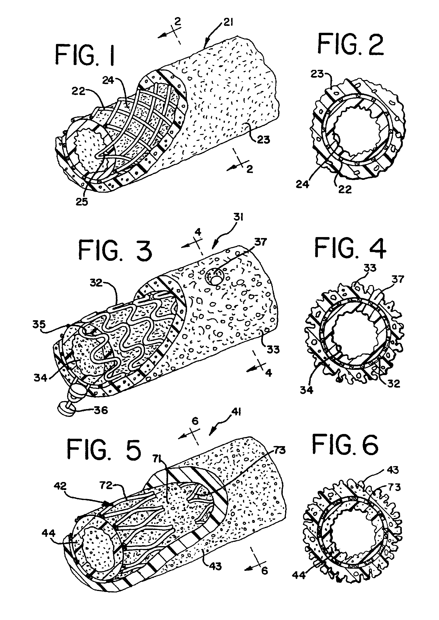 Expandable supportive branched endoluminal grafts