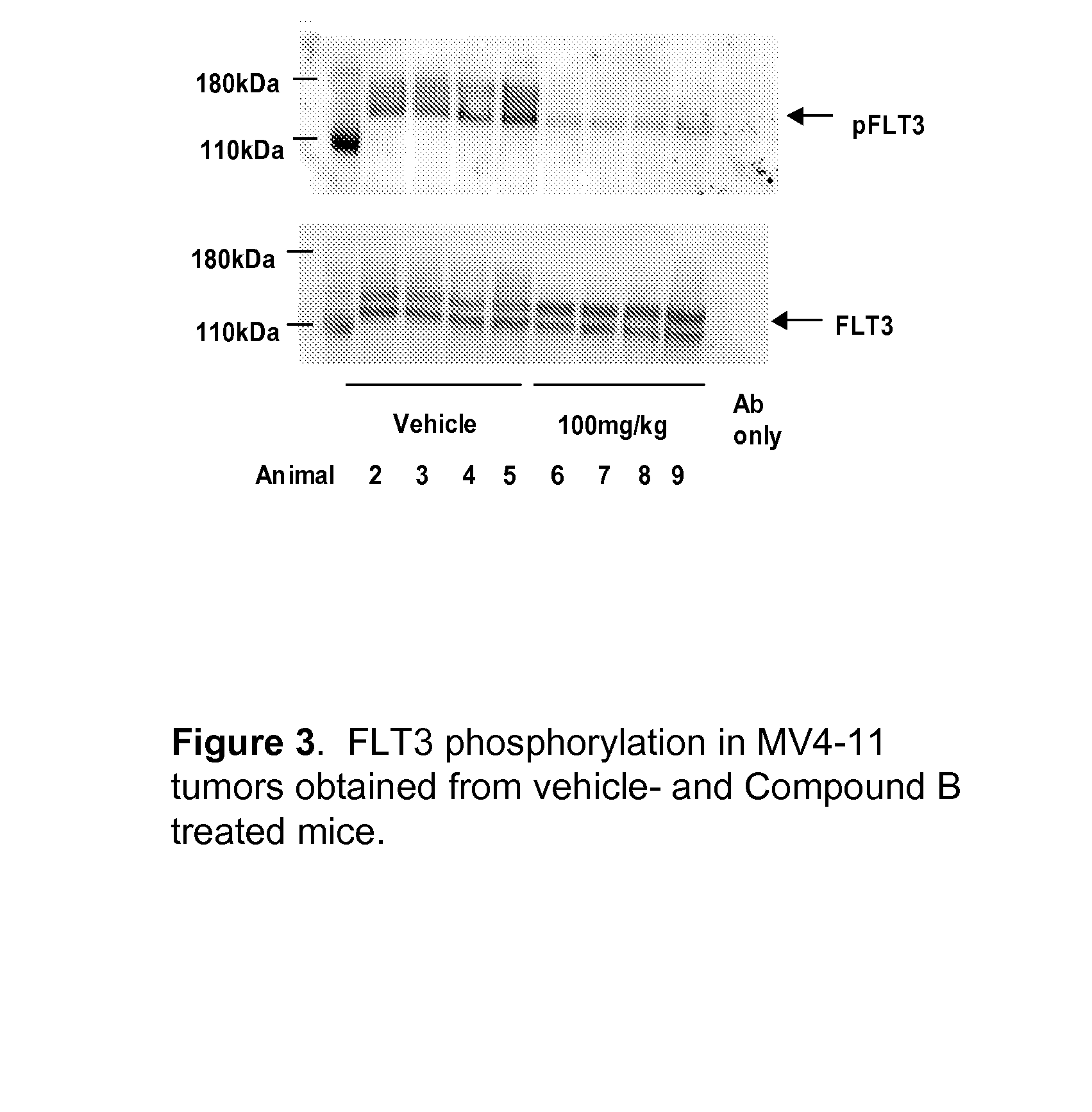 Synergistic modulation of flt3 kinase using a flt3 inhibitor and a farnesyl transferase inhibitor