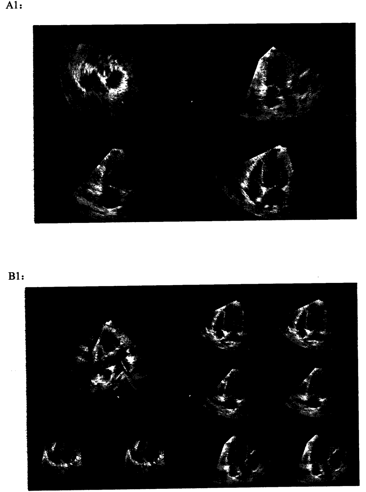 Method and kit for establishing beagle heart insufficiency model