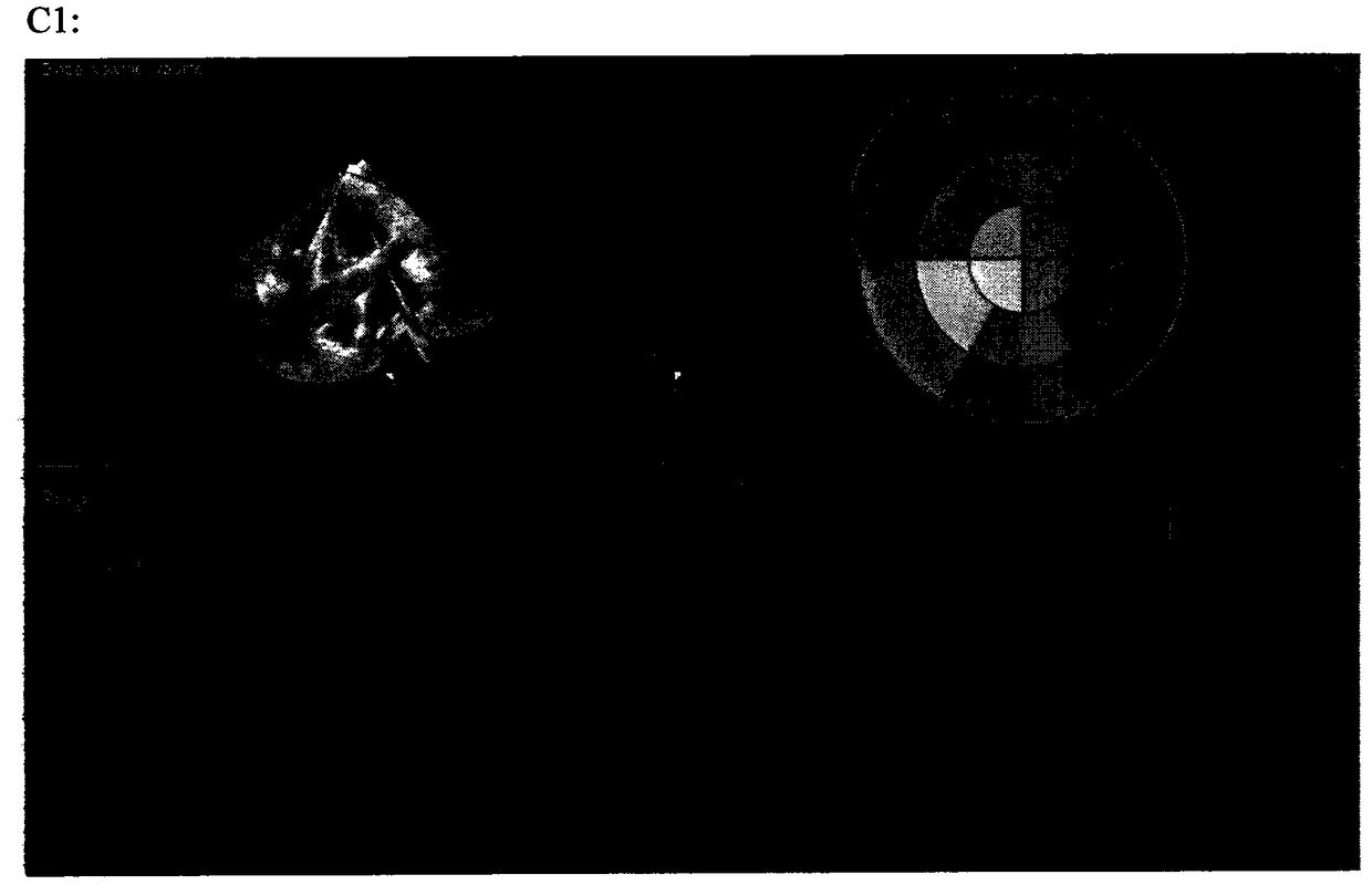 Method and kit for establishing beagle heart insufficiency model