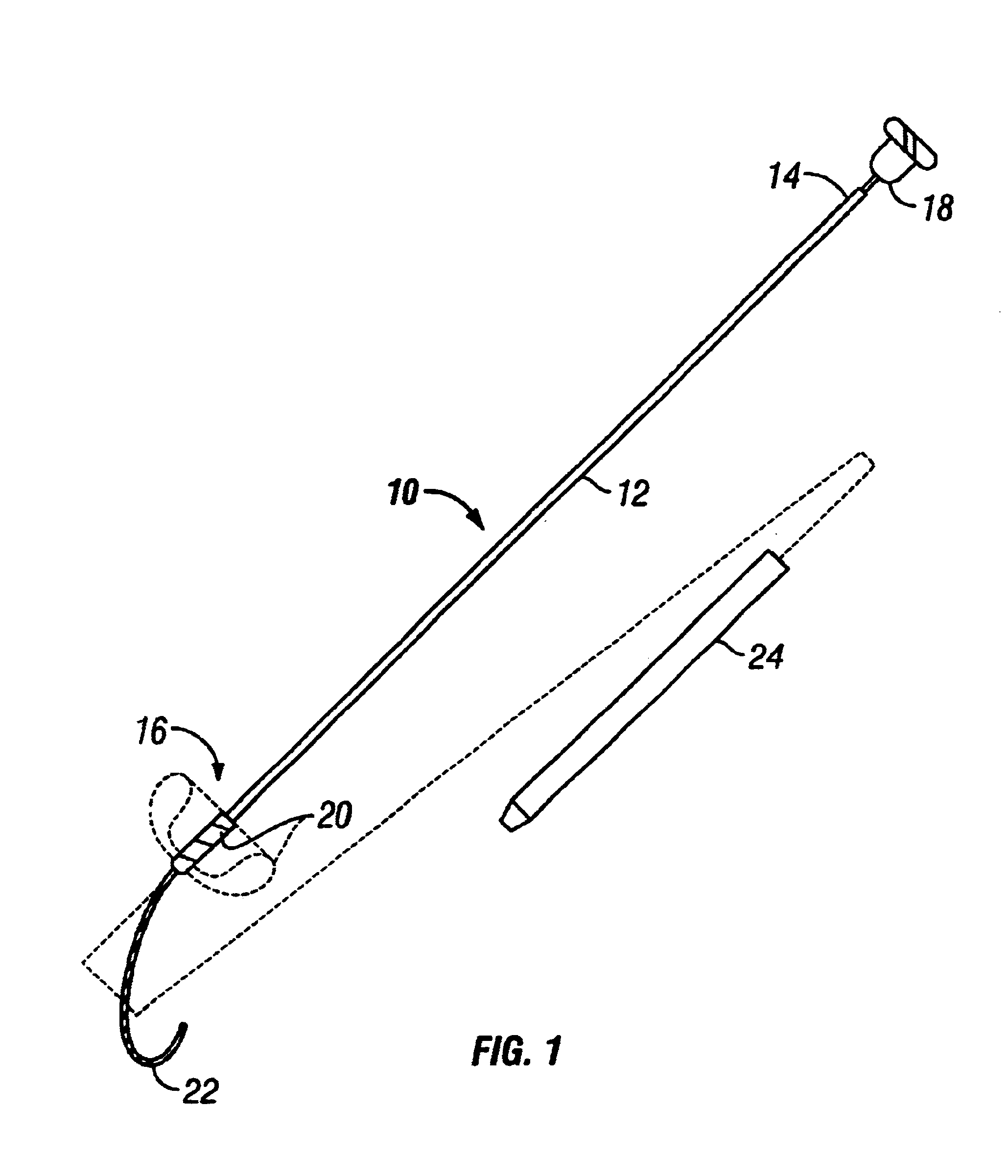 Methods and apparatus for forming anastomotic sites