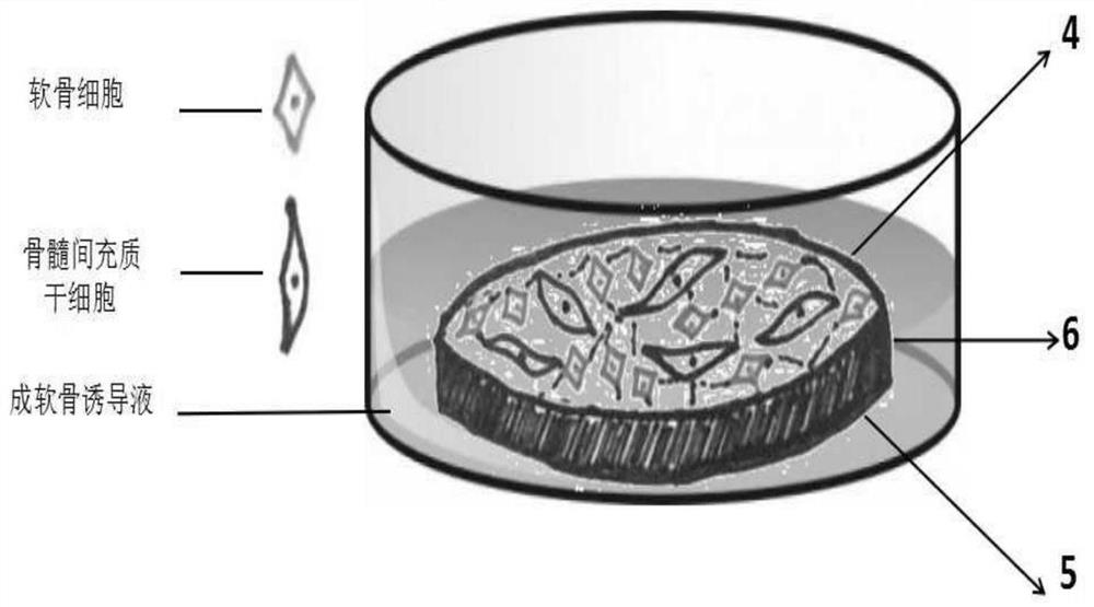 Biological condyle of temporomandibular joint based on tissue engineering related technology