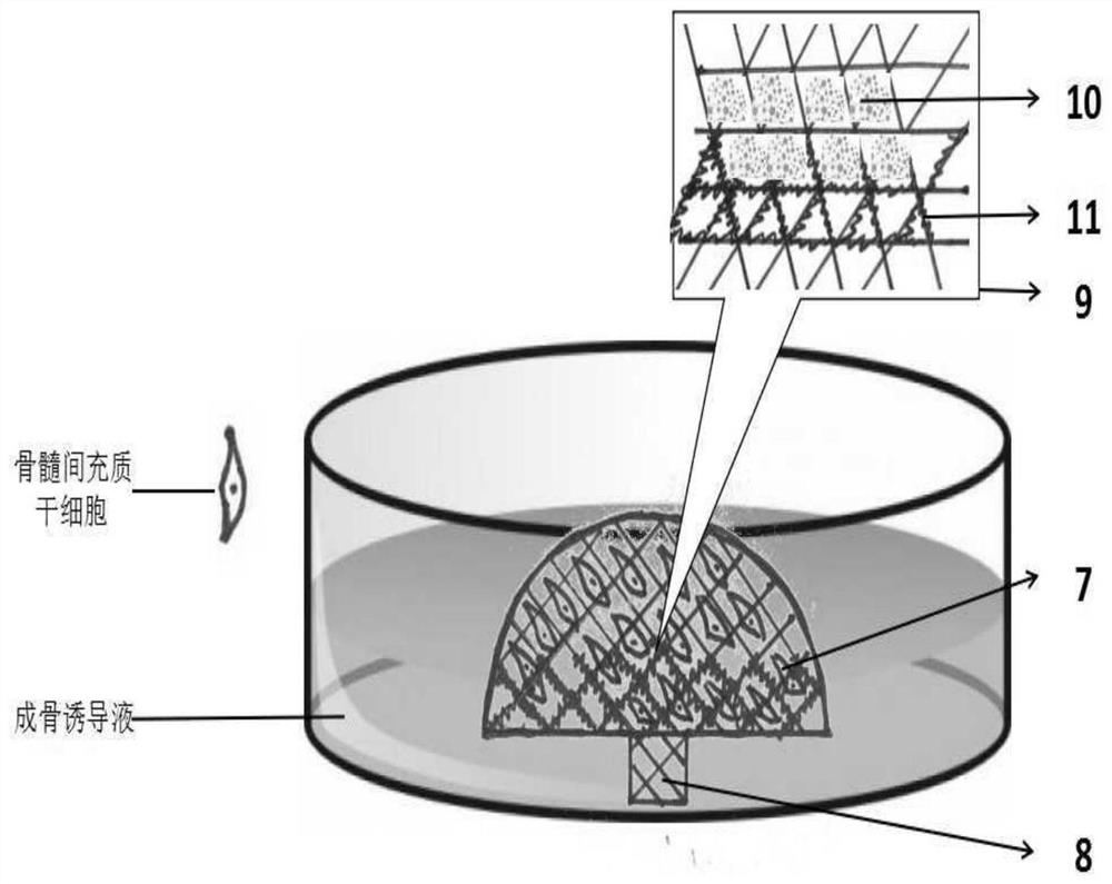 Biological condyle of temporomandibular joint based on tissue engineering related technology