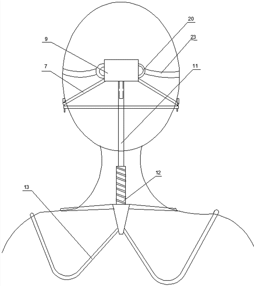 Orthodontic method and device