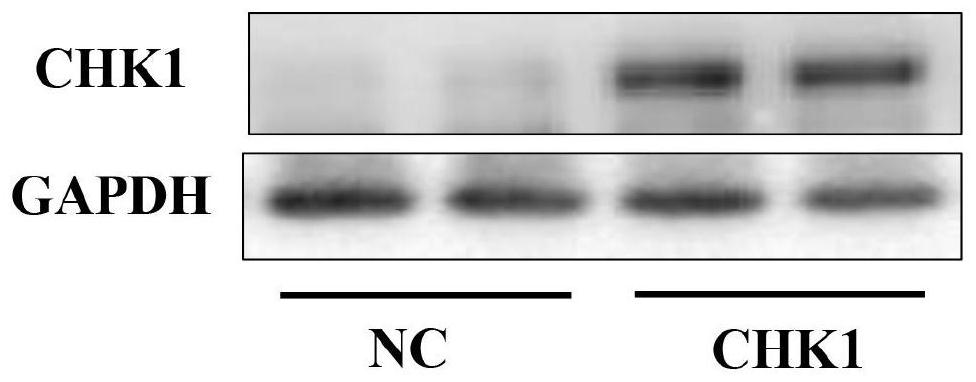 Recombinant human CHK1 protein kinase hydrogel for promoting myocardial regeneration as well as preparation method and application thereof