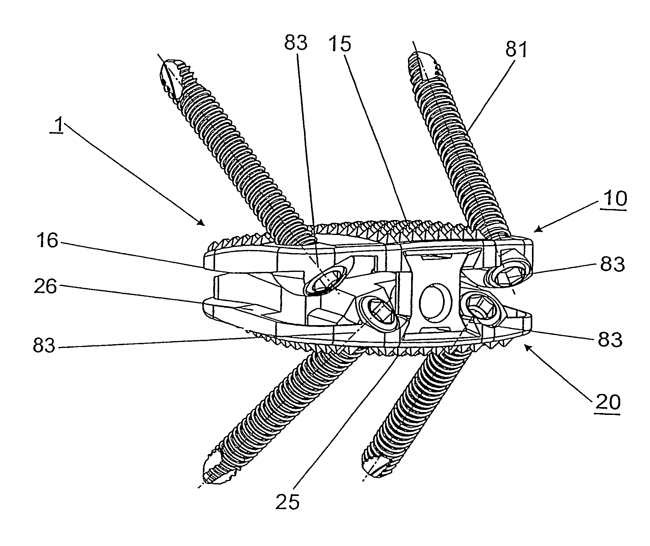 Intervertebral implant comprising joint parts that are mounted to form a universal joint