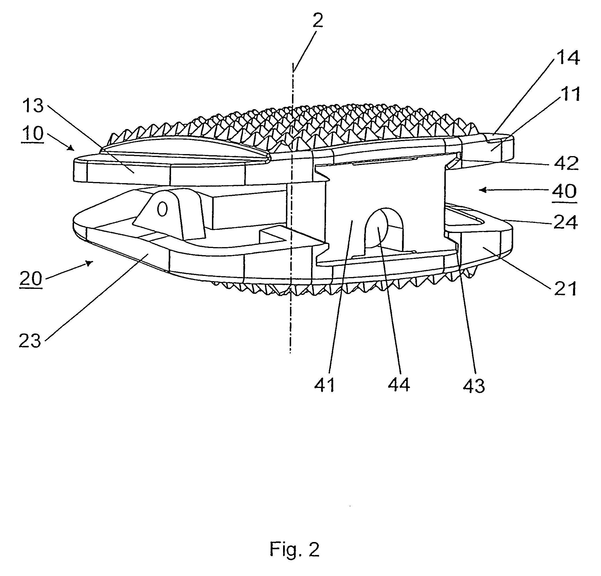 Intervertebral implant comprising joint parts that are mounted to form a universal joint