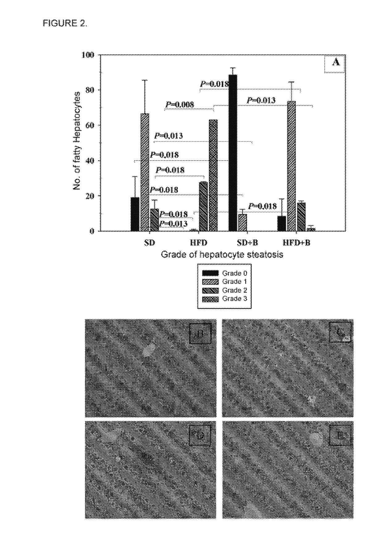 Bacteroides CECT 7771 and the Use Thereof in the Prevention and Treatment of Excess Weight, Obesity and Metabolic and Immunological Alterations