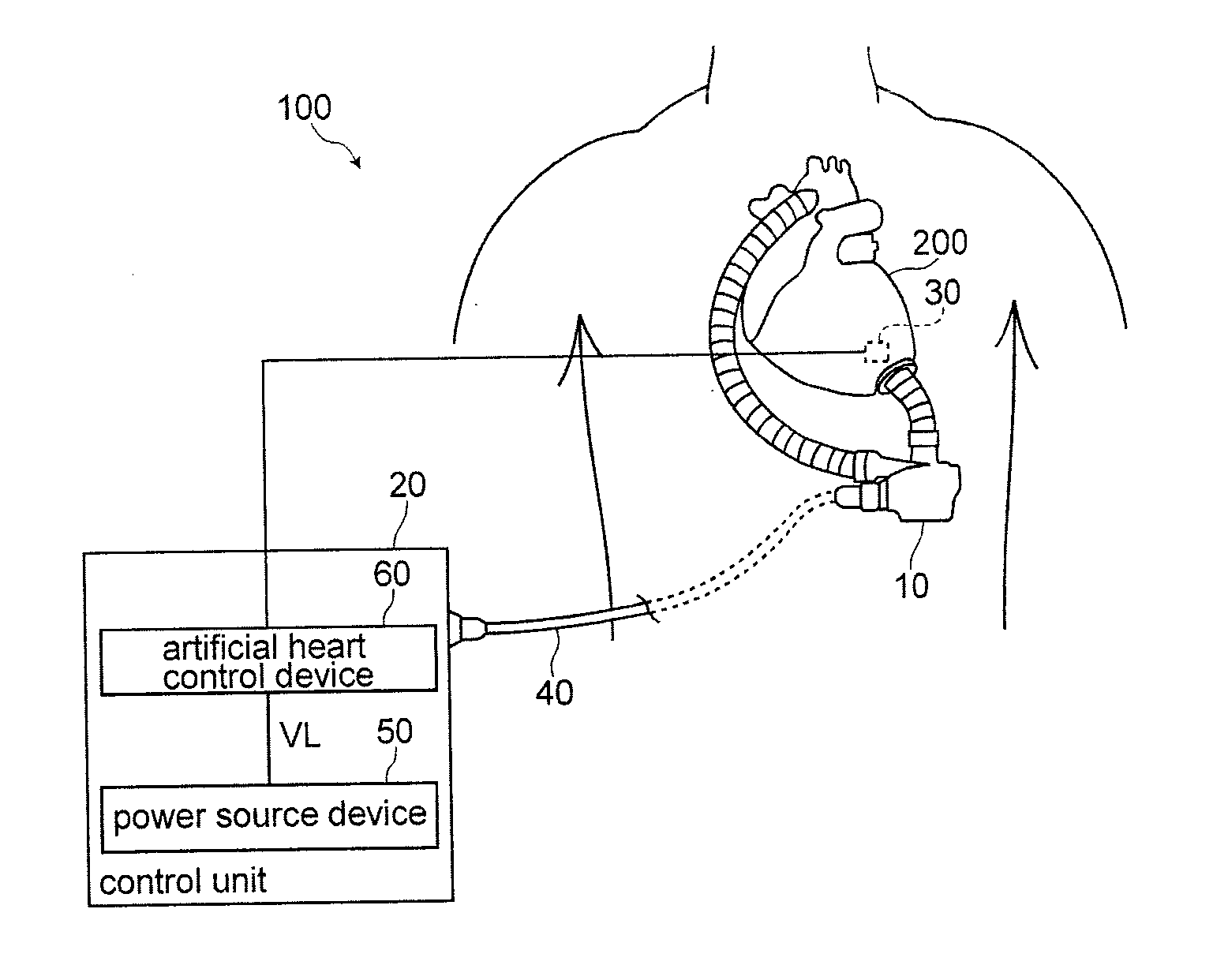 Artificial heart control device, artificial heart system and artificial heart control method