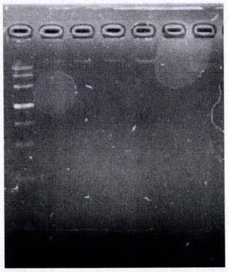 Natural deficient mutant strain of PhoP gene existing in clinical isolates of mycobacterium tuberculosis in Xinjiang areas