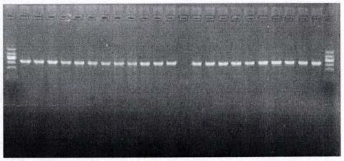 Natural deficient mutant strain of PhoP gene existing in clinical isolates of mycobacterium tuberculosis in Xinjiang areas