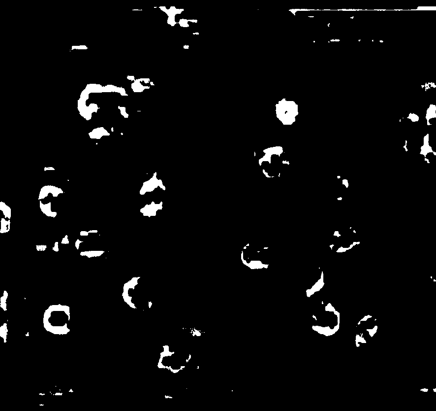 Visual saliency and SIFT characteristic based echinococcosis protoscolex survival rate detection method