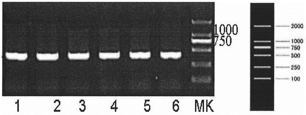 Serum CENPF antibody quantitative detection kit