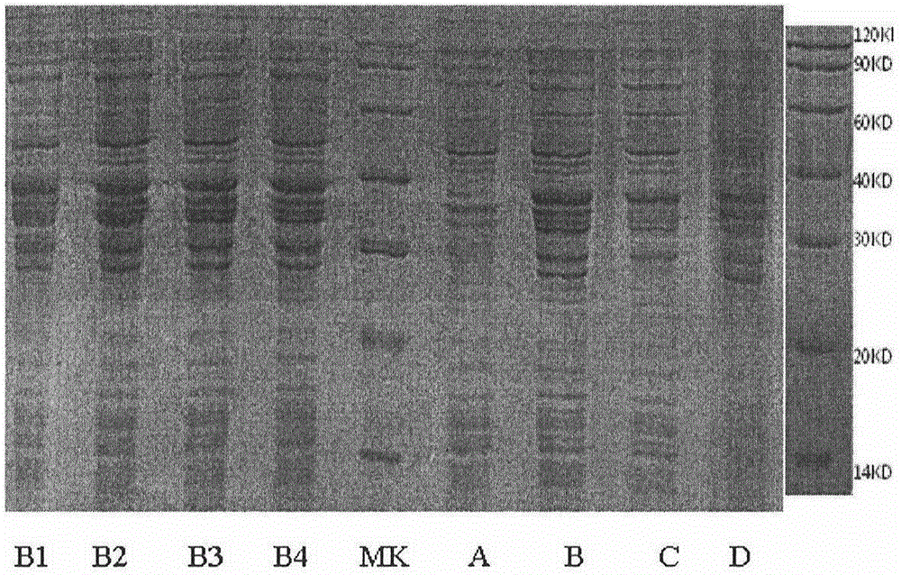 Serum CENPF antibody quantitative detection kit