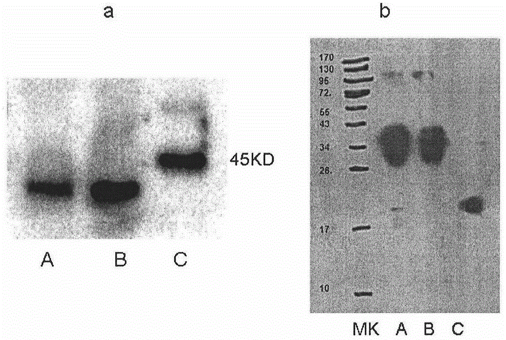 Serum CENPF antibody quantitative detection kit