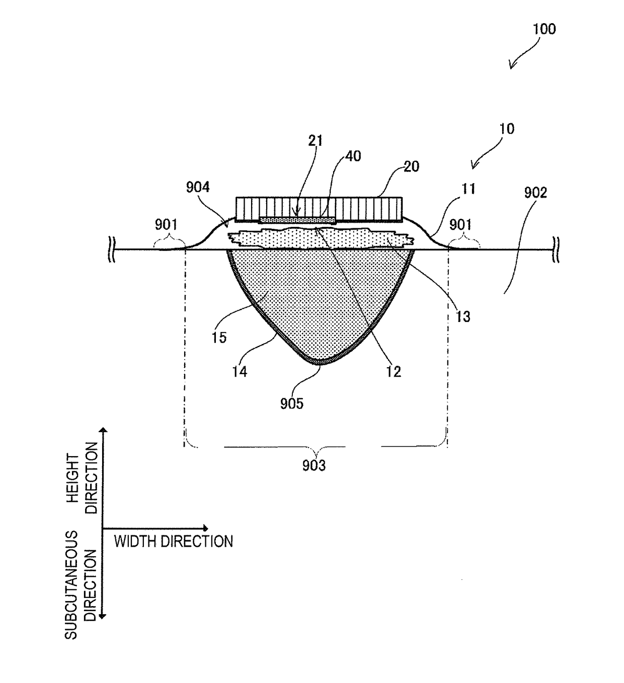 Negative pressure wound therapy device