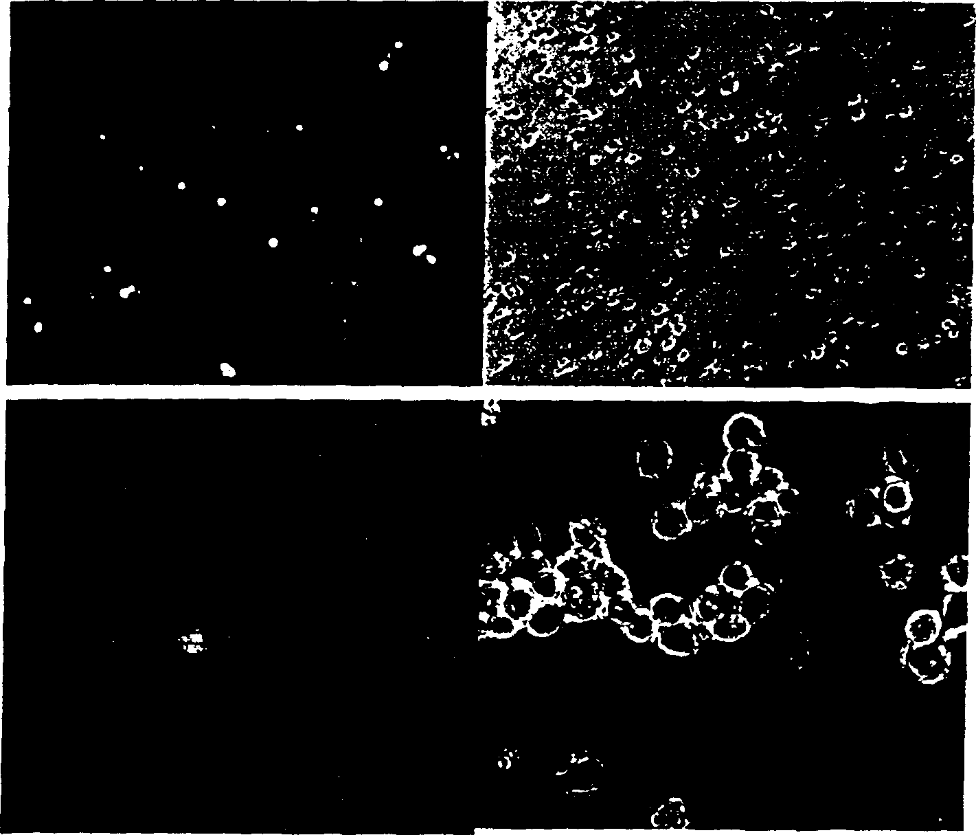 Method of fast increasing glandular related virus mediating gene in expression of inside of retina cell