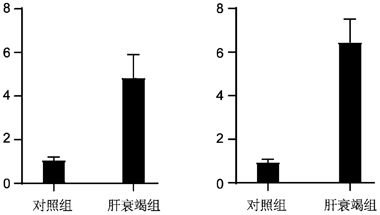 New use of CTSG for diagnosing liver failure, kit and application of kit for diagnosing liver failure