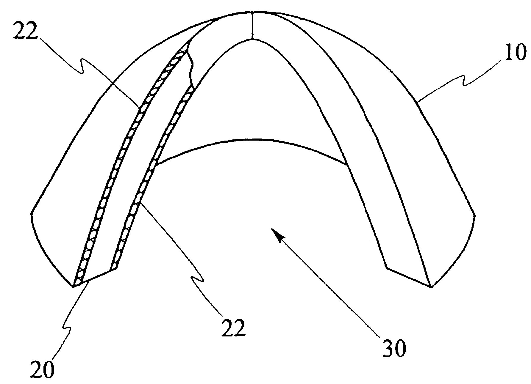 Apparatus and method for blast suppression