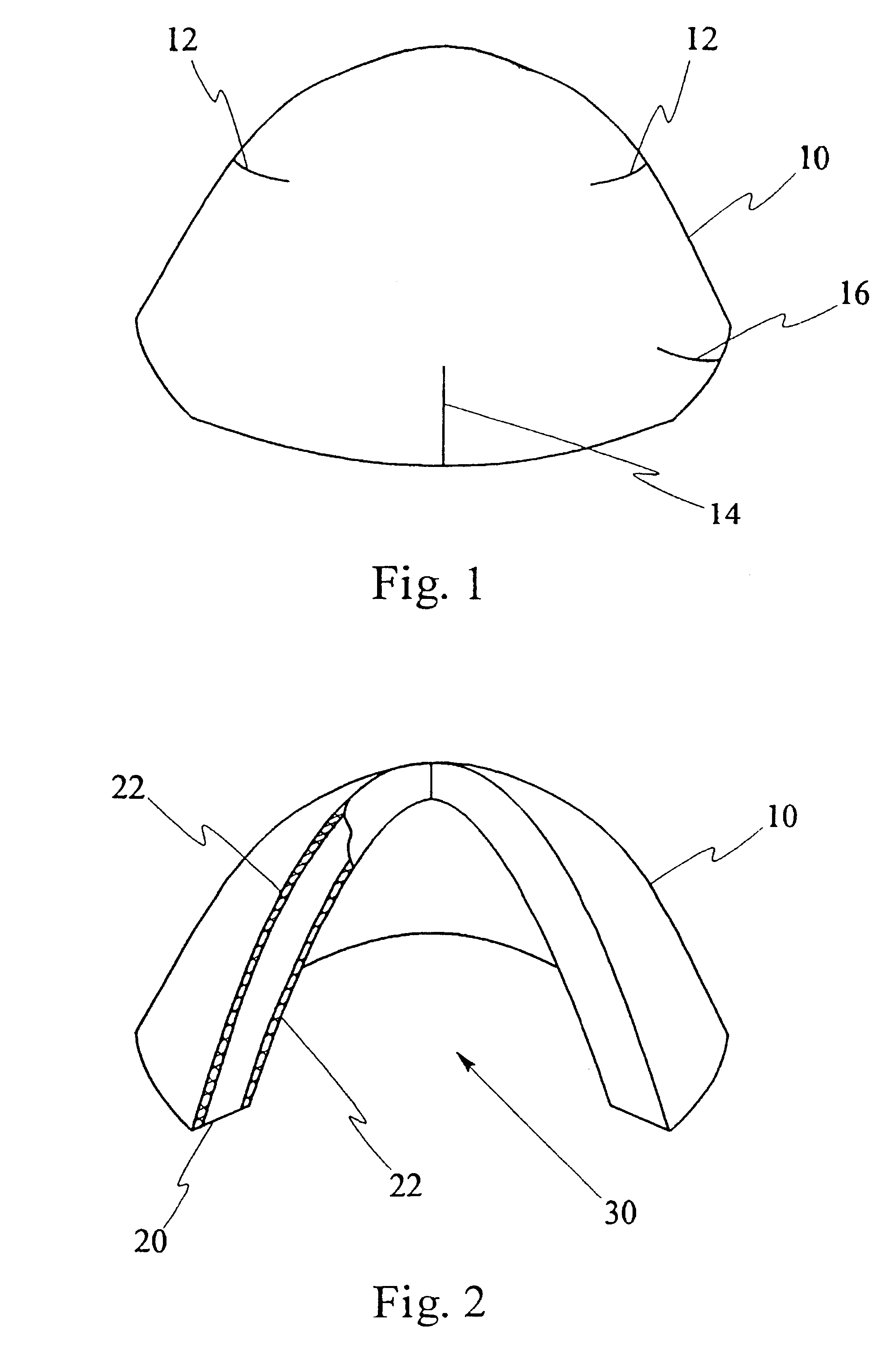 Apparatus and method for blast suppression