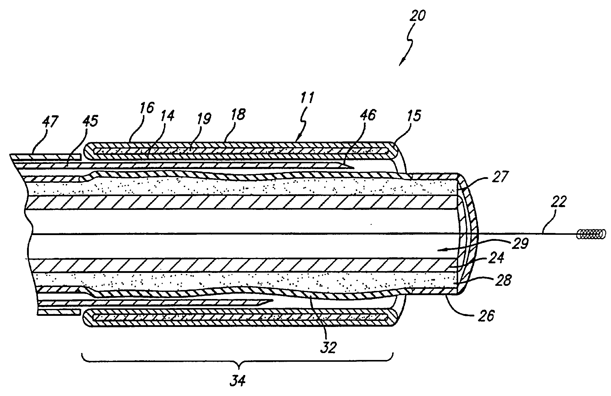 Two stage light curable stent and delivery system