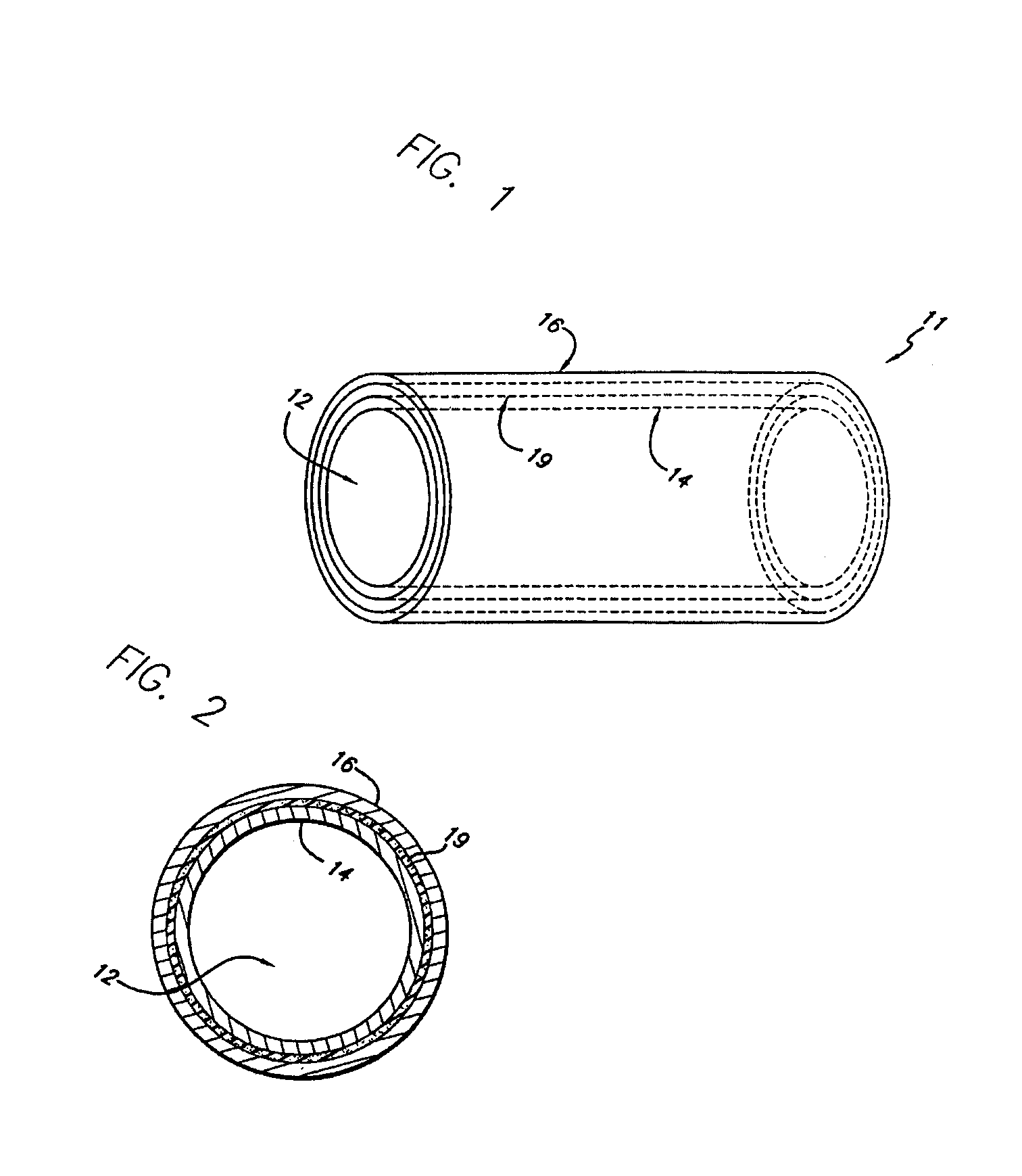 Two stage light curable stent and delivery system