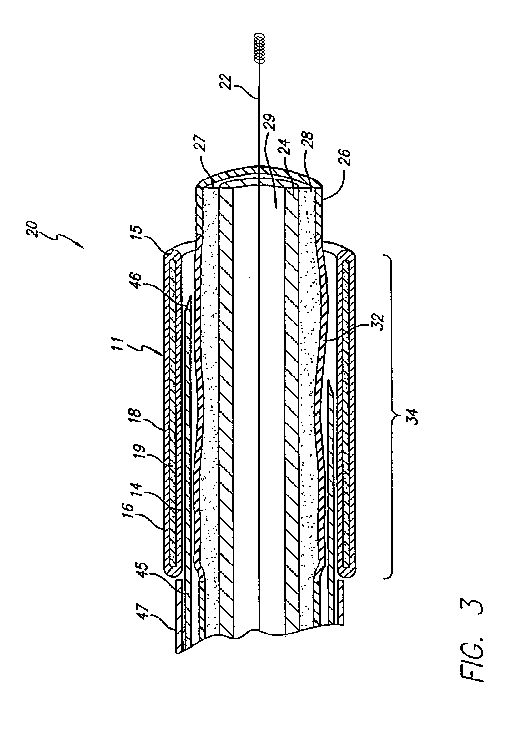 Two stage light curable stent and delivery system