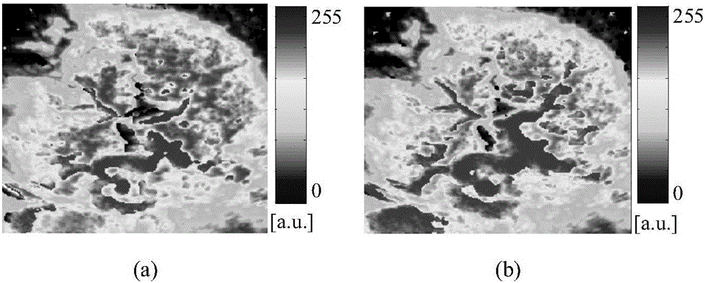 Ultrasound contrast perfusion parameter imaging method based on respiratory motion compensation