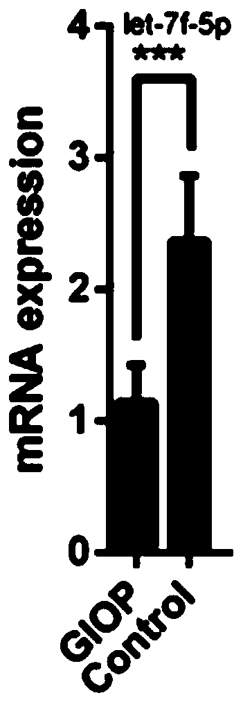 Let-7f-5p and application of target gene thereof for preparing medicine for treating osteoporosis