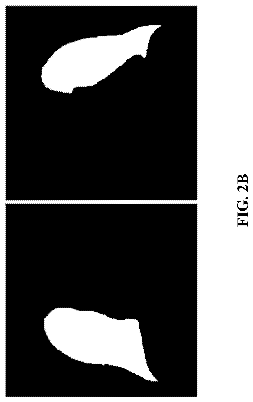 Method to read chest image