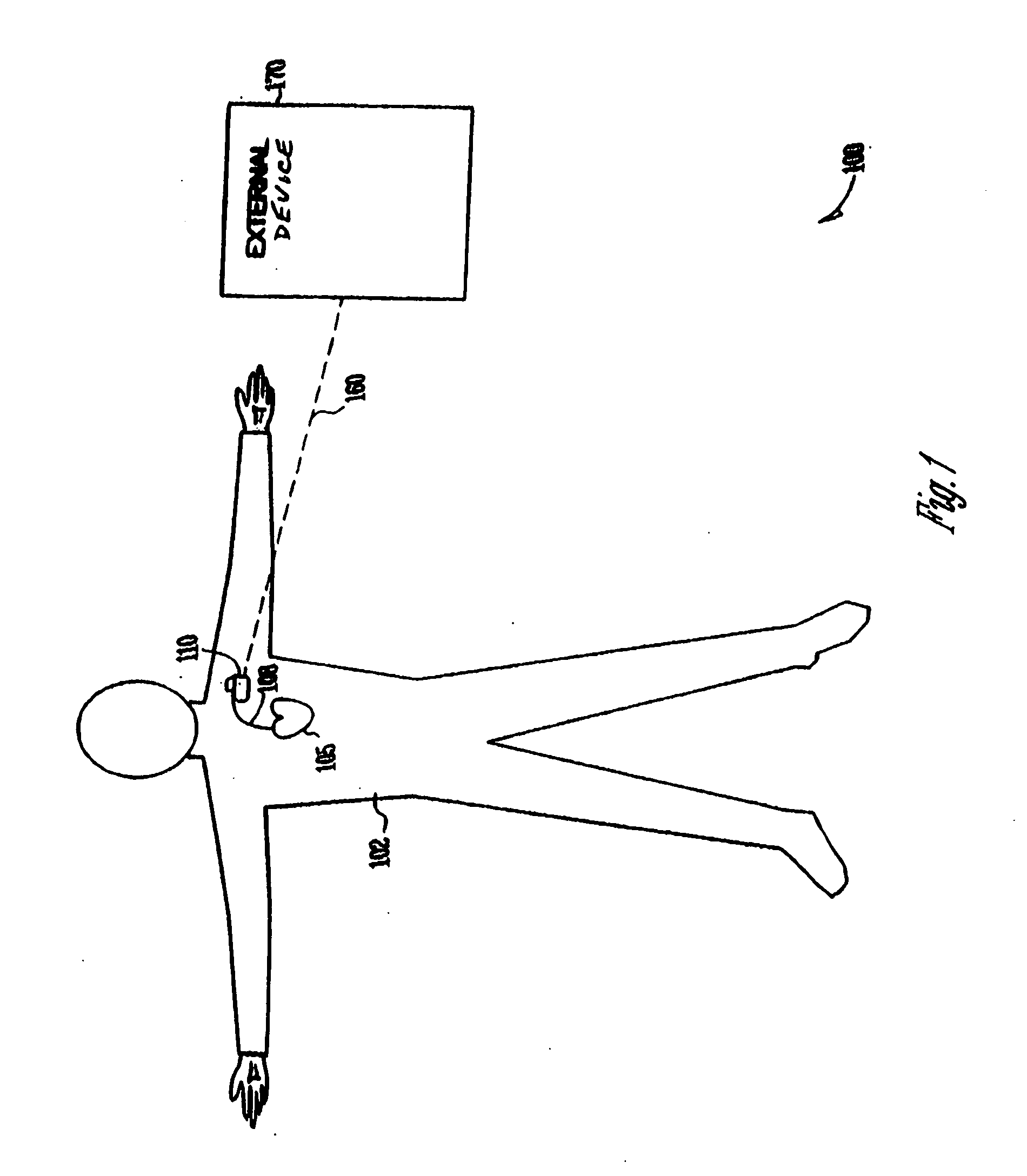 Therapy control based on the rate of change of intracardiac impedance