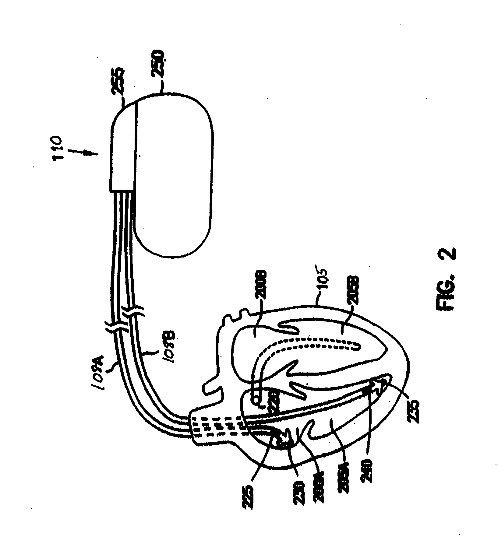 Therapy control based on the rate of change of intracardiac impedance