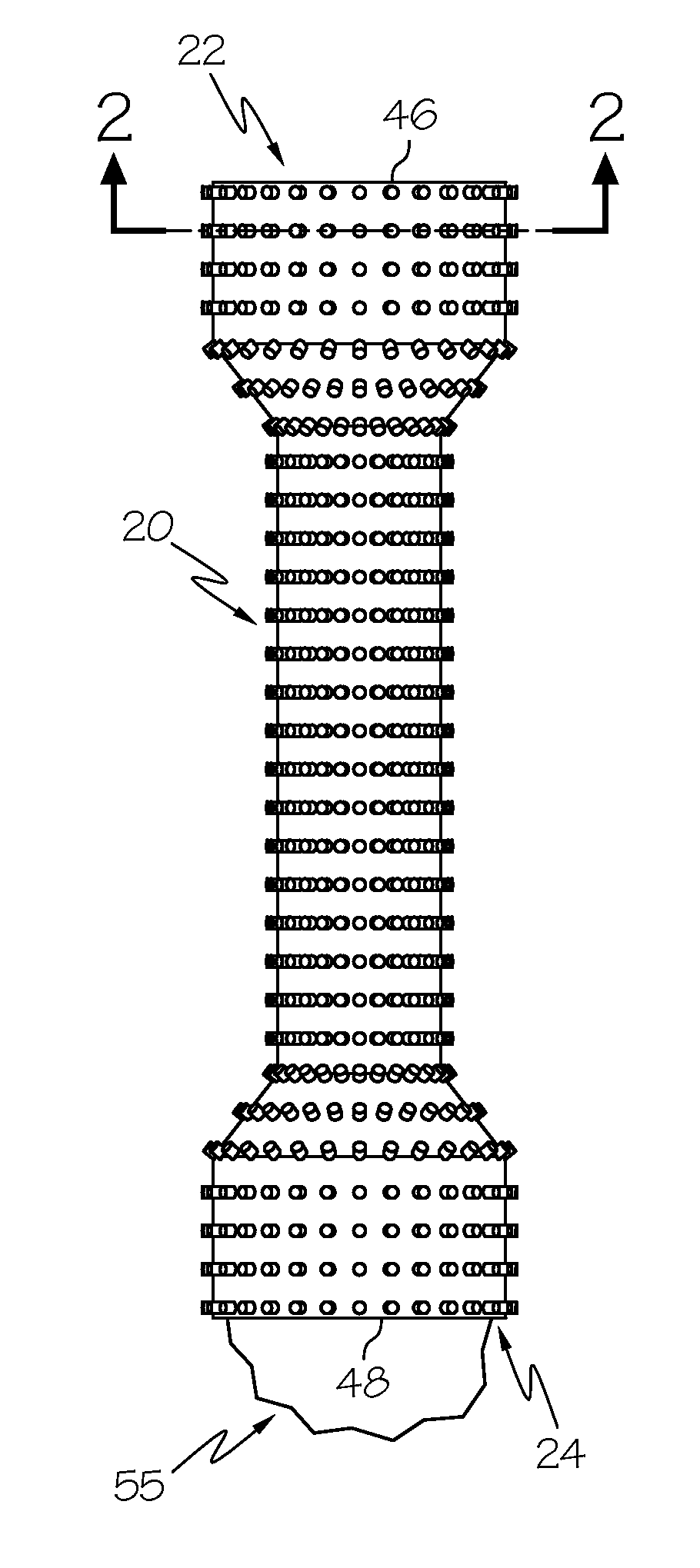 Covered Endoscopic Stents with Adhesion Elements