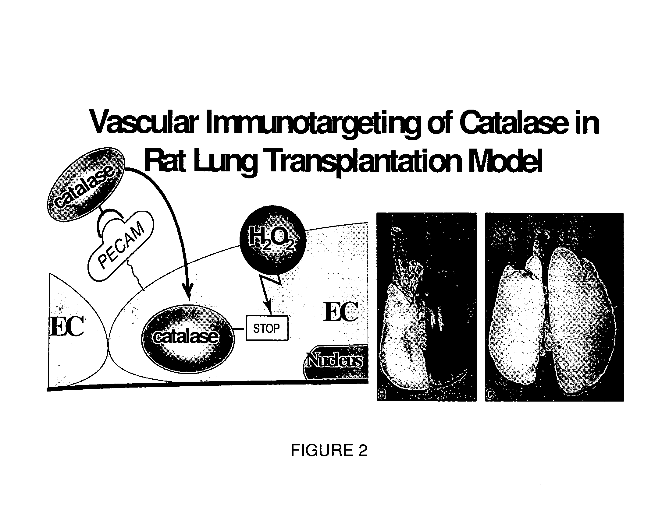 Flaxseed lignan complex, methods of using AMD compositions thereof