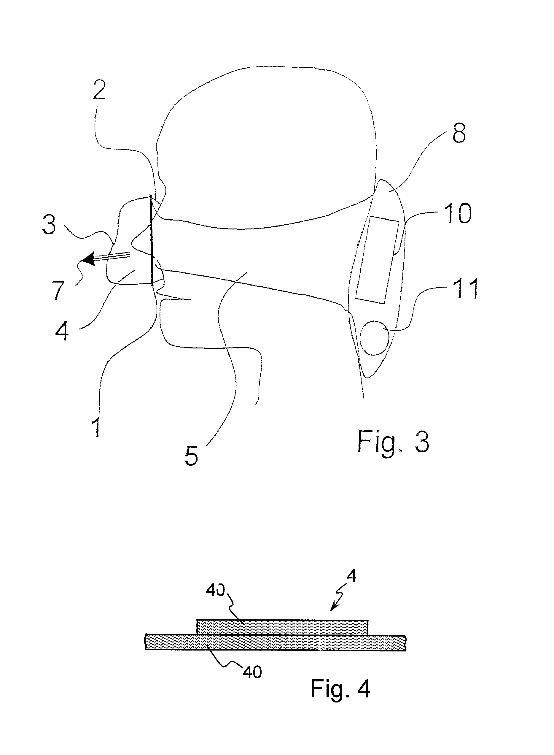 Breathing mask with breathing gas supply through the strap