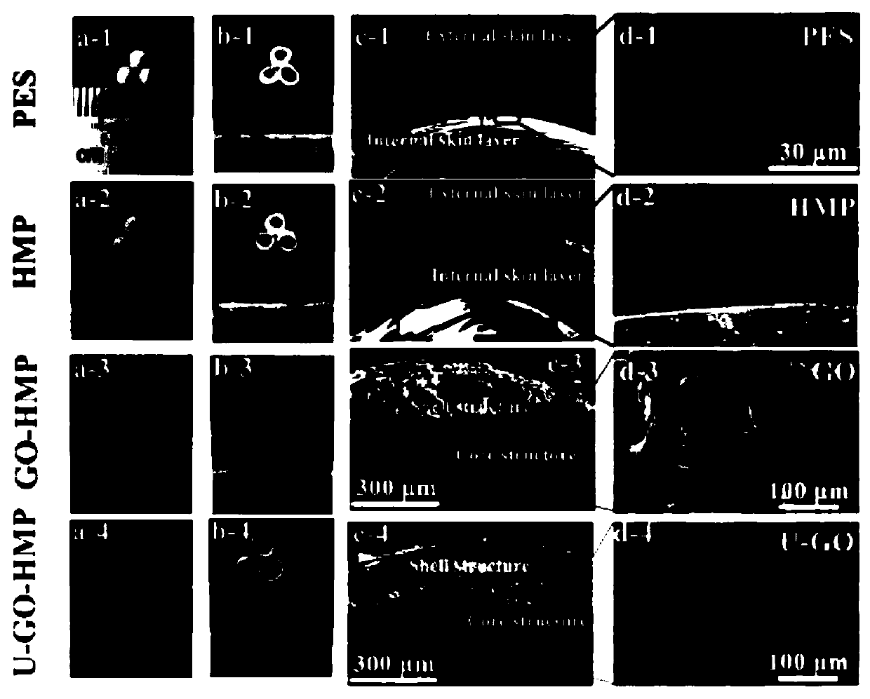 Core-shell structured heparinoid microsphere based on graphene oxide grafted urease, and preparation method and applications of core-shell structured heparinoid microsphere