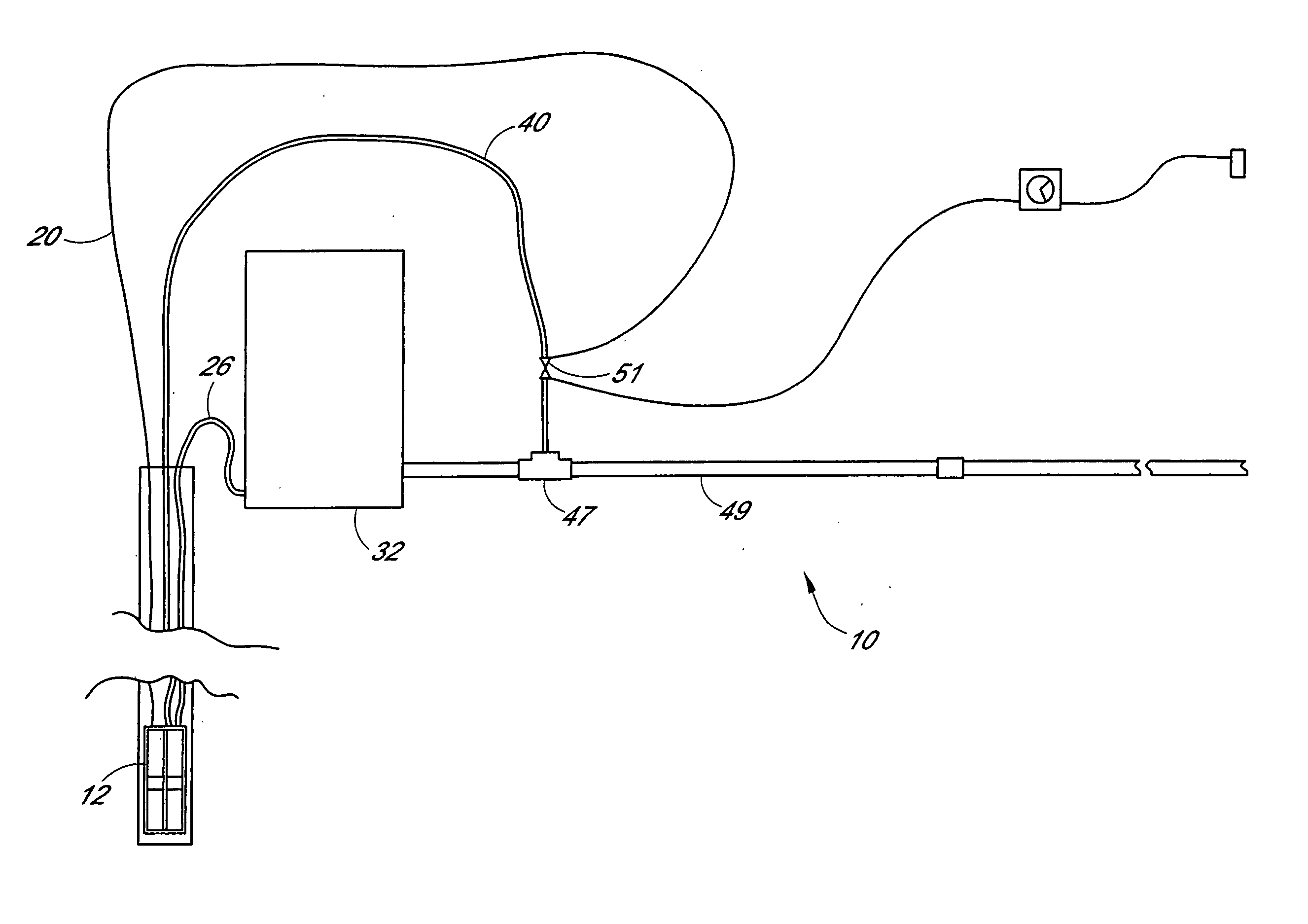 Method and system for filtering sediment-bearing fluids