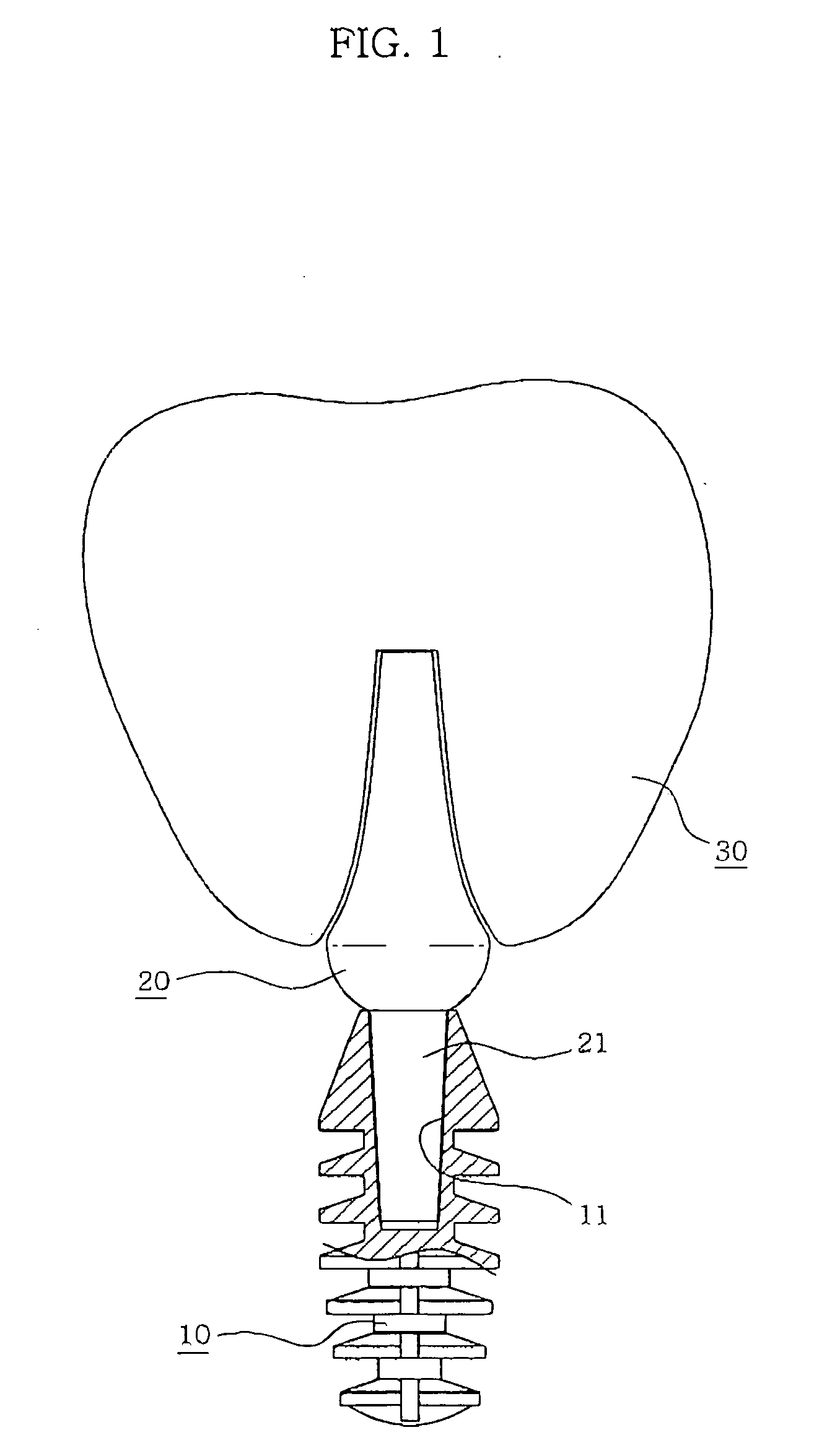 Abutment of implant system