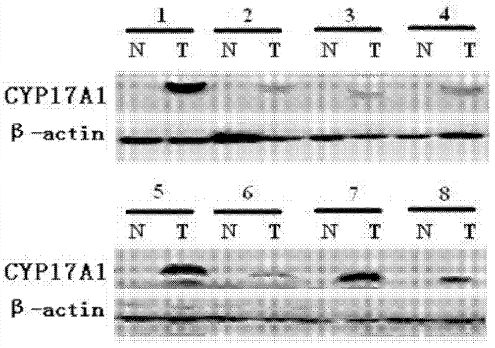 Marker for diagnosing liver cancer and application thereof