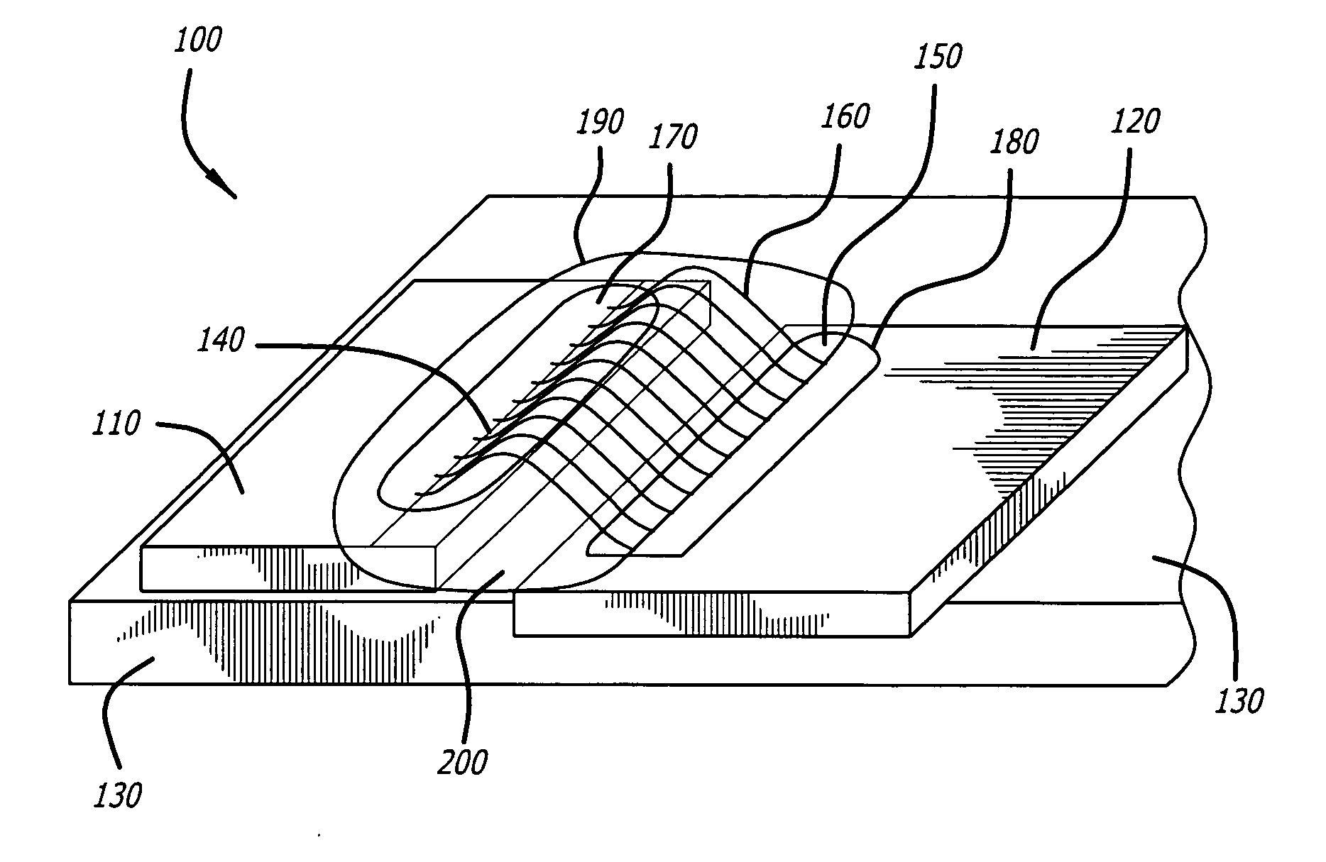 Encapsulation of circuit components to reduce thermal cycling stress