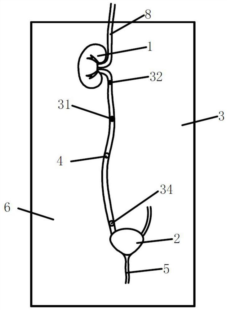 Rigid ureteroscope/flexible ureteroscope teaching mold and preparation and operation methods thereof