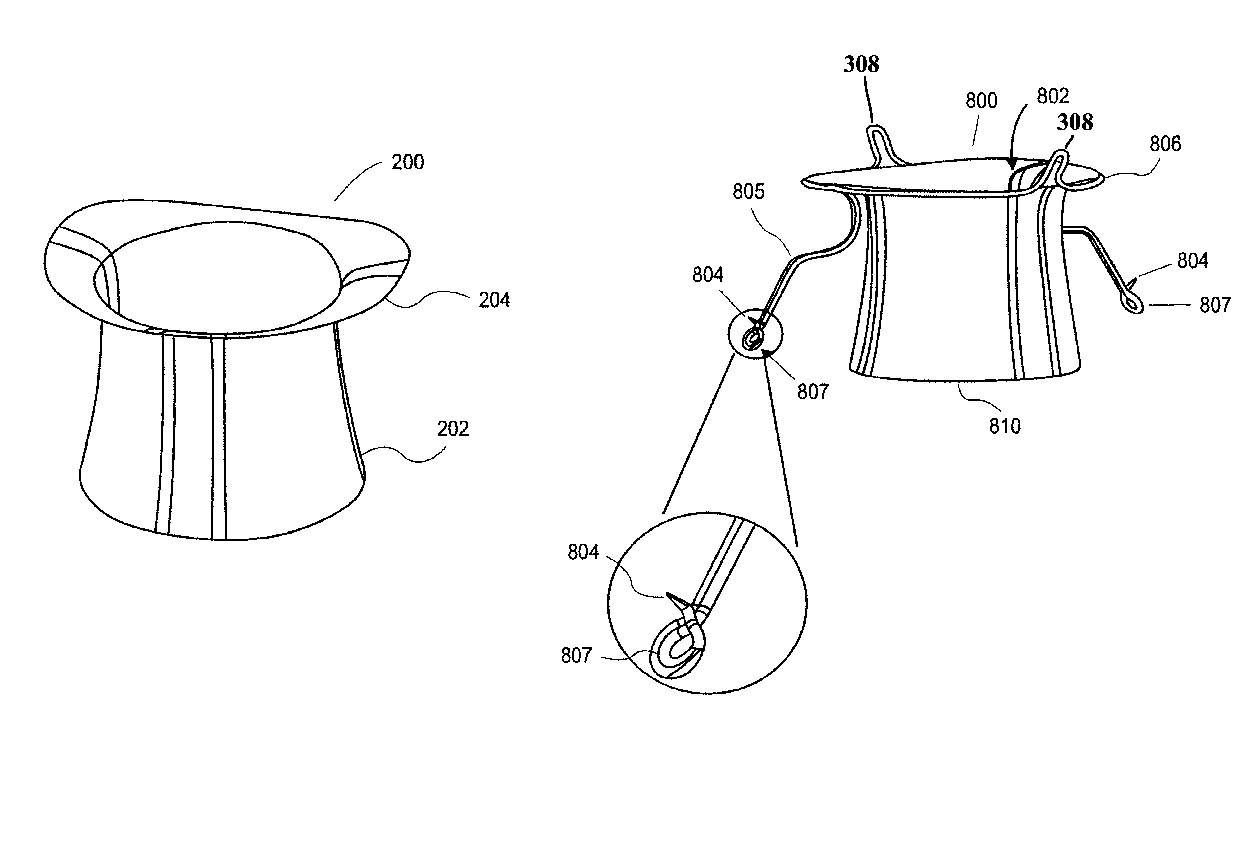 Heart valve prosthesis with collapsible valve and method of delivery thereof