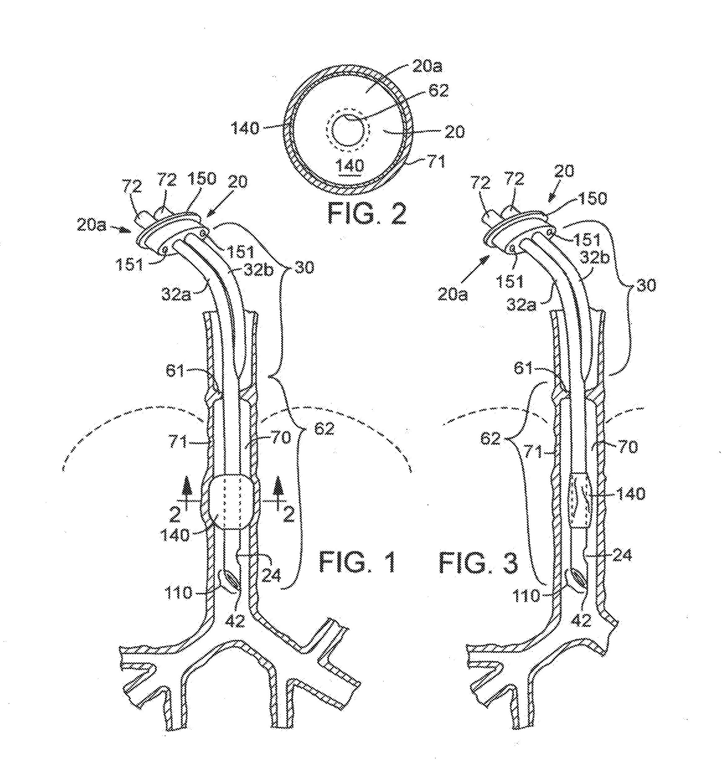 Secretion clearing ventilation catheter and airway management system