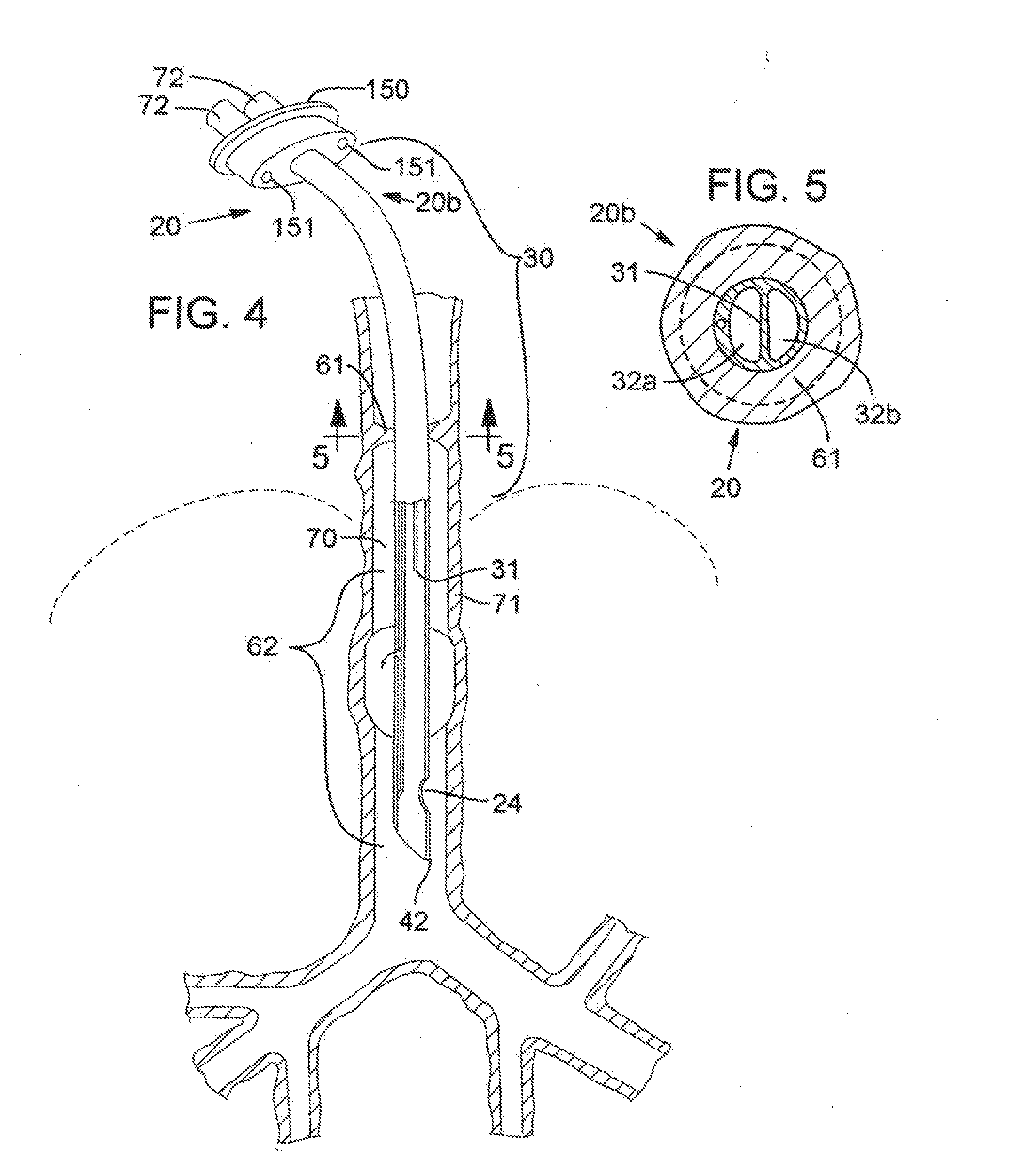 Secretion clearing ventilation catheter and airway management system